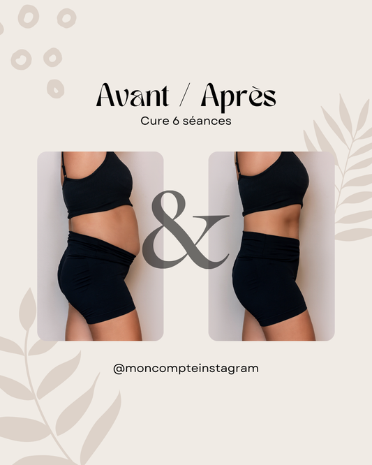 50 modèles de posts "Avant / Après" - Madérothérapie
